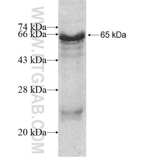 TUBGCP4 fusion protein Ag9976 SDS-PAGE