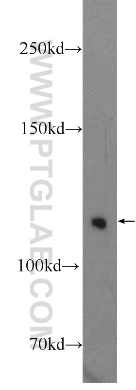 Western Blot (WB) analysis of mouse brain tissue using TUBGCP5 Polyclonal antibody (14620-1-AP)