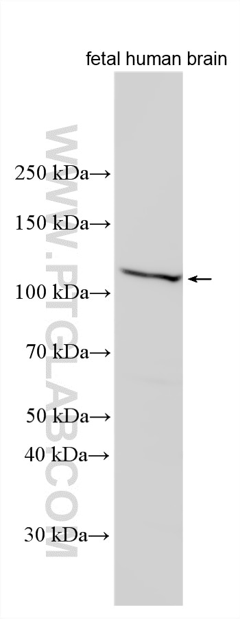Various lysates were subjected to SDS PAGE followed by western blot with 14620-1-AP (TUBGCP5 antibody) at dilution of 1:500 incubated at room temperature for 1.5 hours. Western Blot (WB) analysis of various lysates using TUBGCP5 Polyclonal antibody (14620-1-AP)