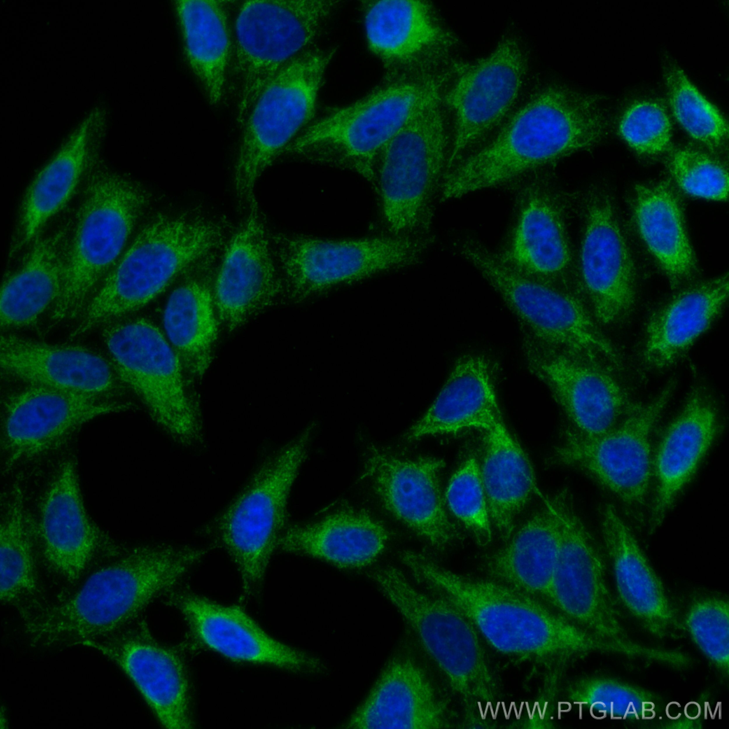 Immunofluorescence (IF) / fluorescent staining of HepG2 cells using TUFM Polyclonal antibody (26730-1-AP)