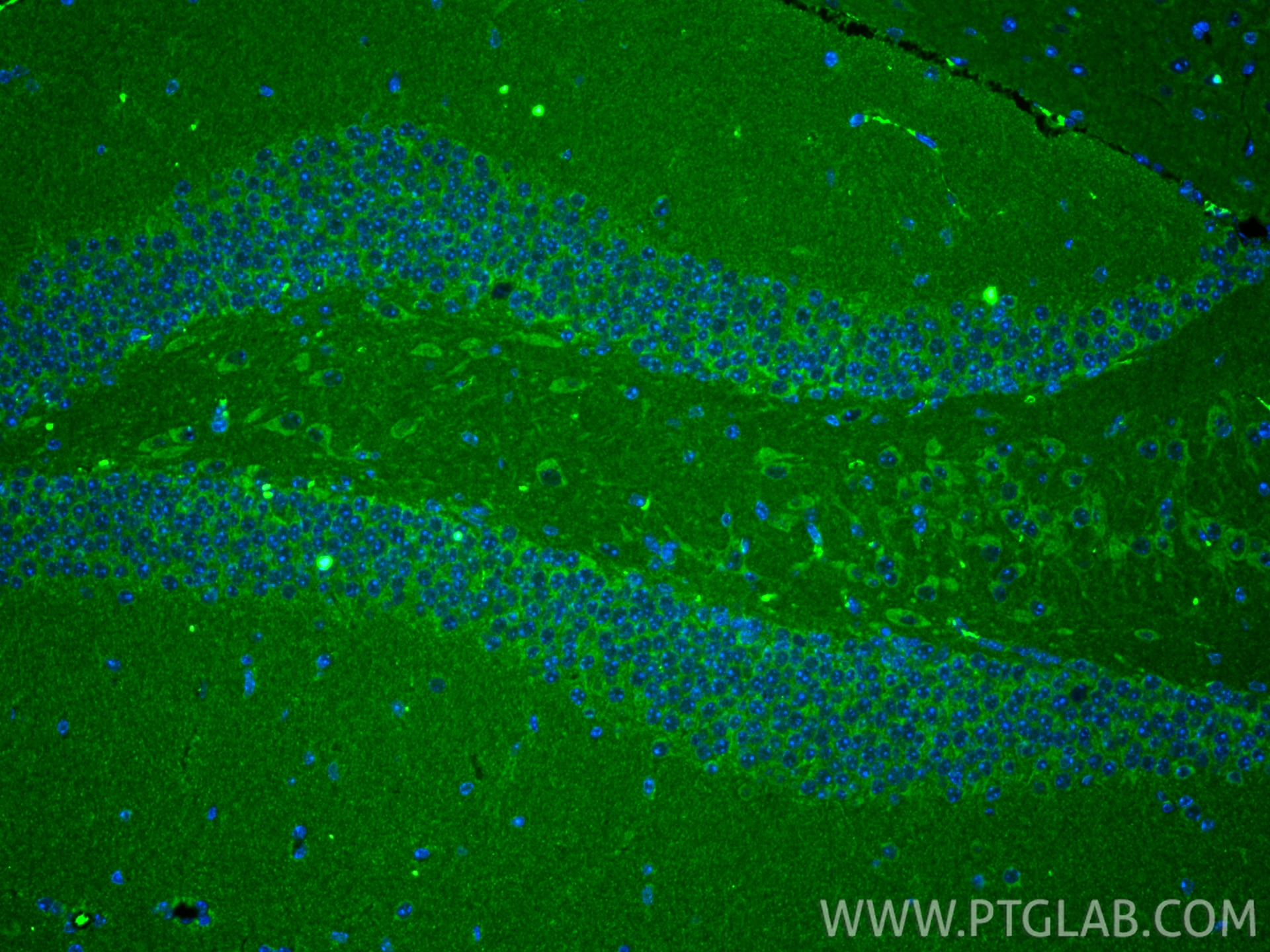 IF Staining of mouse brain using 67802-1-Ig Immunofluorescence (IF) / fluorescent staining of mouse brain tissue using TUFM Monoclonal antibody (67802-1-Ig)