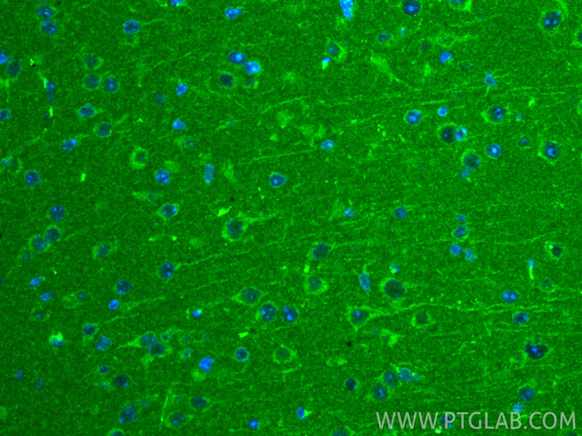 IF Staining of mouse brain using 67802-1-Ig Immunofluorescence (IF) / fluorescent staining of mouse brain tissue using TUFM Monoclonal antibody (67802-1-Ig)