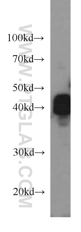 Western Blot (WB) analysis of HeLa cells using TUFT1 Polyclonal antibody (23385-1-AP)