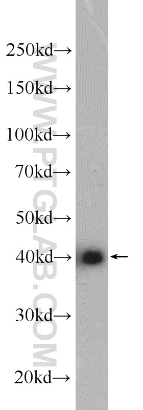 Western Blot (WB) analysis of HEK-293 cells using TUFT1 Polyclonal antibody (23385-1-AP)