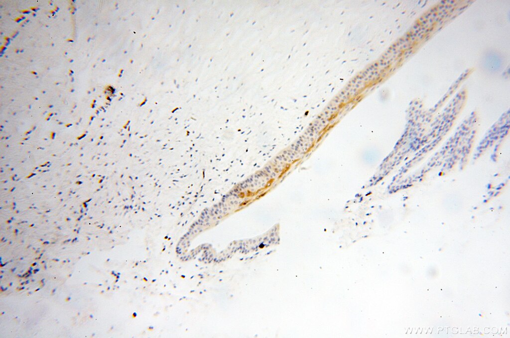 Immunohistochemistry (IHC) staining of human eye tissue using TULP1 Polyclonal antibody (18971-1-AP)