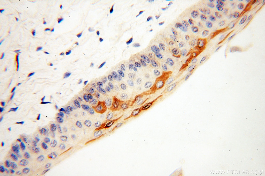 Immunohistochemistry (IHC) staining of human eye tissue using TULP1 Polyclonal antibody (18971-1-AP)