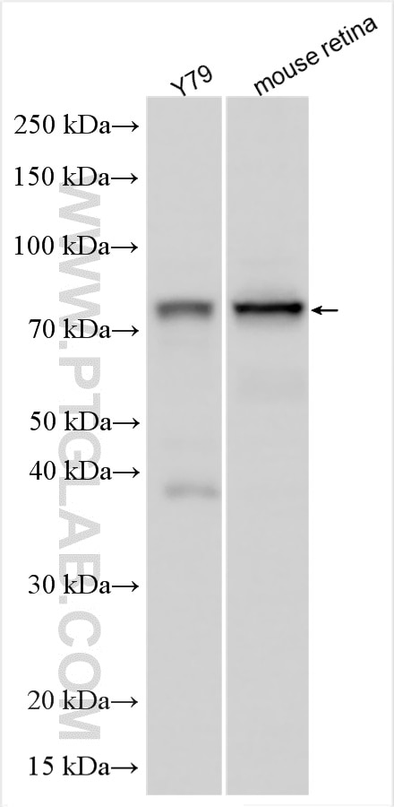 Western Blot (WB) analysis of various lysates using TULP1 Polyclonal antibody (18971-1-AP)
