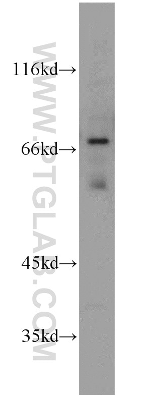 Western Blot (WB) analysis of human brain tissue using TULP1 Polyclonal antibody (18971-1-AP)