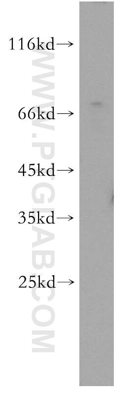 Western Blot (WB) analysis of human brain tissue using TULP1 Polyclonal antibody (18971-1-AP)