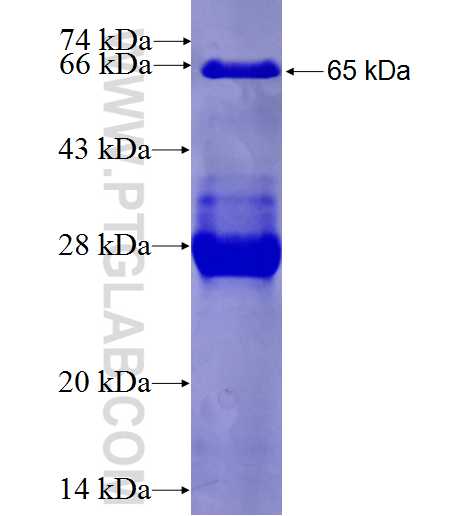 TULP1 fusion protein Ag4478 SDS-PAGE