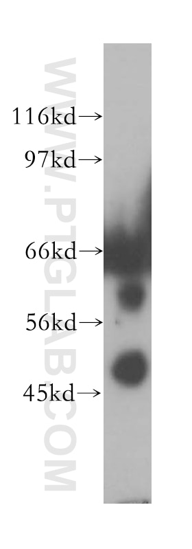 Western Blot (WB) analysis of human lung tissue using TULP2 Polyclonal antibody (12668-1-AP)