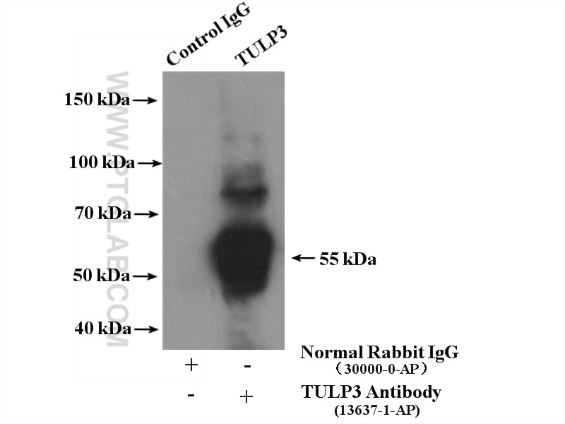 Immunoprecipitation (IP) experiment of SH-SY5Y cells using TULP3 Polyclonal antibody (13637-1-AP)