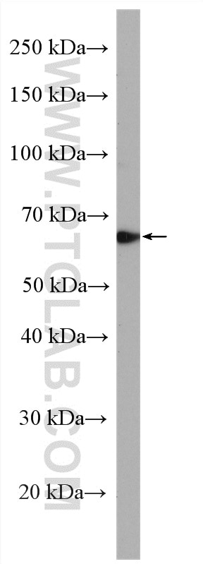 Western Blot (WB) analysis of SH-SY5Y cells using TULP3 Polyclonal antibody (13637-1-AP)