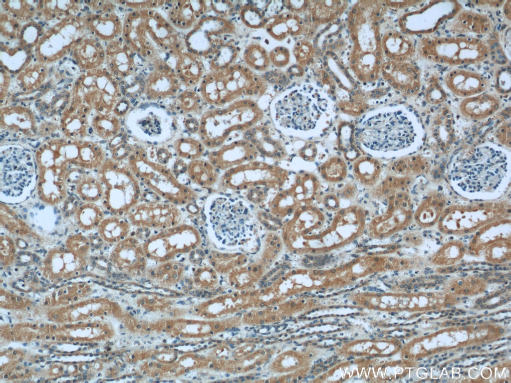 Immunohistochemistry (IHC) staining of human kidney tissue using TULP4 Polyclonal antibody (55155-1-AP)