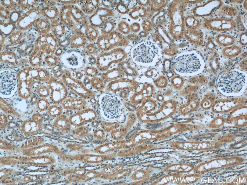 IHC staining of human kidney using 55155-1-AP