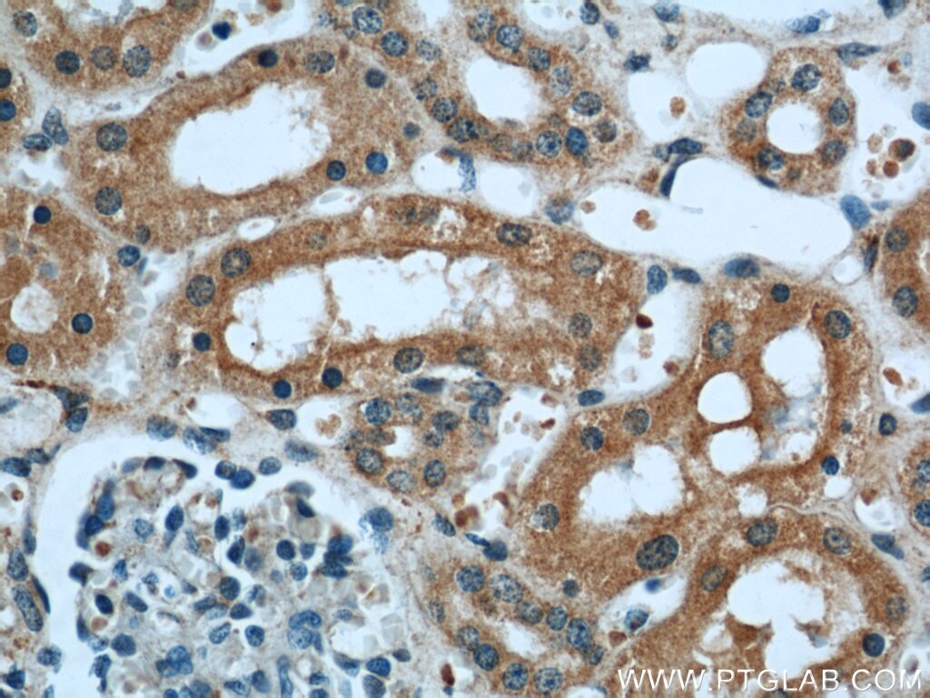 Immunohistochemistry (IHC) staining of human kidney tissue using TULP4 Polyclonal antibody (55155-1-AP)