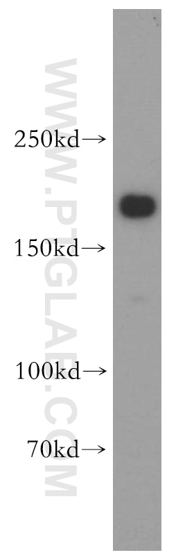 Western Blot (WB) analysis of human brain tissue using TULP4 Polyclonal antibody (55155-1-AP)