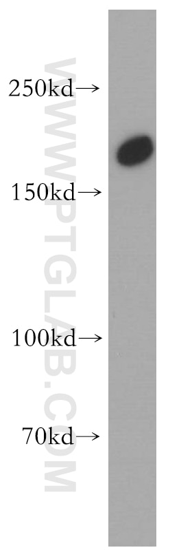 Western Blot (WB) analysis of human skeletal muscle tissue using TULP4 Polyclonal antibody (55155-1-AP)