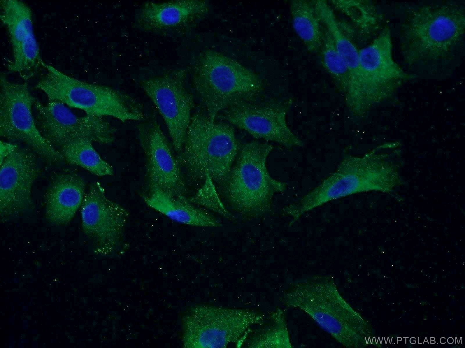 Immunofluorescence (IF) / fluorescent staining of A549 cells using TUSC2 Polyclonal antibody (11538-1-AP)