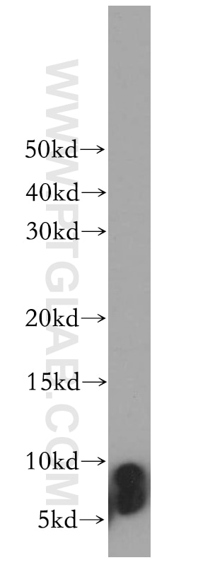 Western Blot (WB) analysis of mouse pancreas tissue using TUSC2 Polyclonal antibody (11538-1-AP)