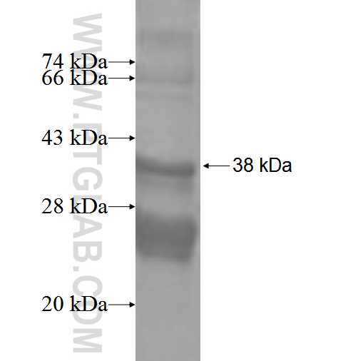 TUSC2 fusion protein Ag2118 SDS-PAGE