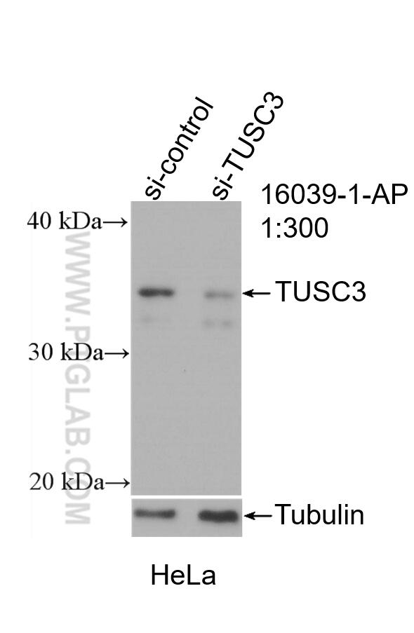 Western Blot (WB) analysis of HeLa cells using TUSC3 Polyclonal antibody (16039-1-AP)