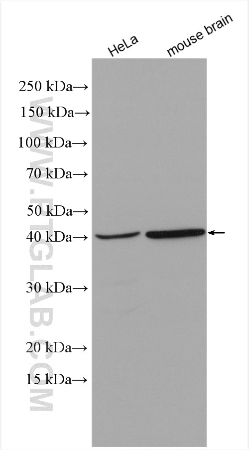Western Blot (WB) analysis of various lysates using TUSC3 Polyclonal antibody (16039-1-AP)