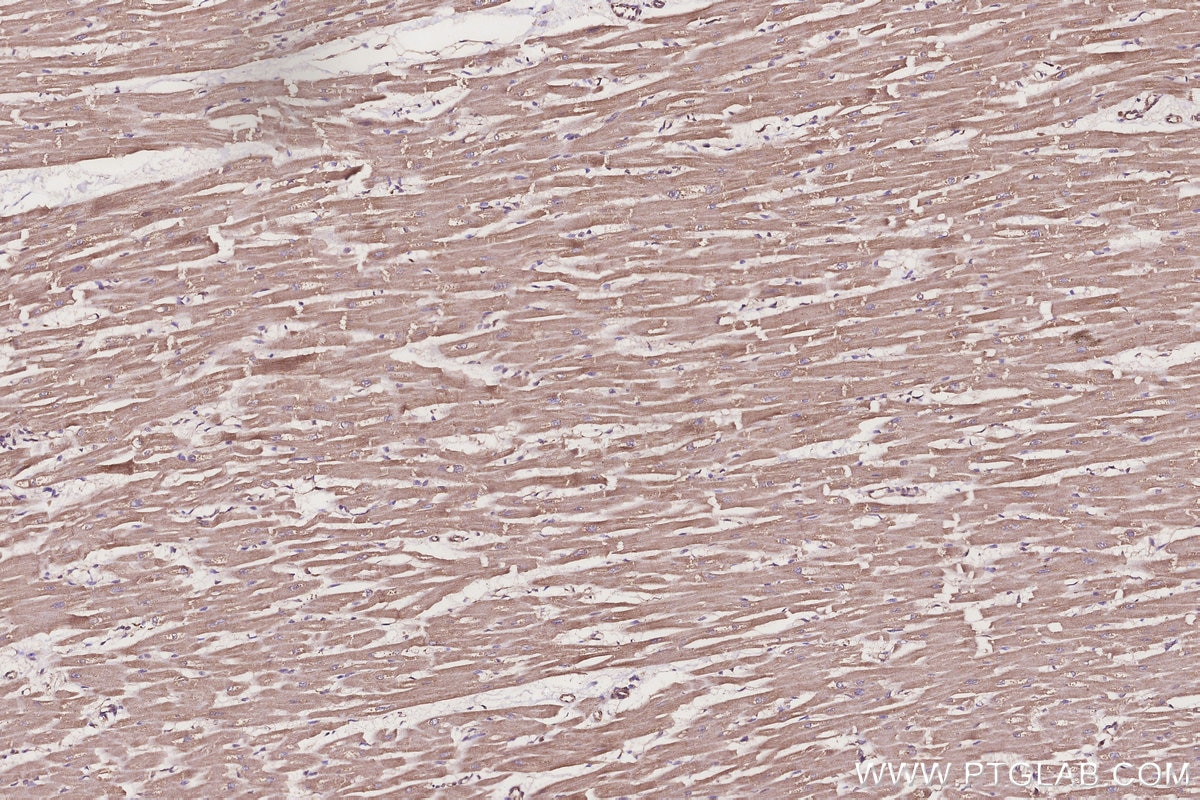 Immunohistochemistry (IHC) staining of human heart tissue using TUSC3 Monoclonal antibody (67382-1-Ig)