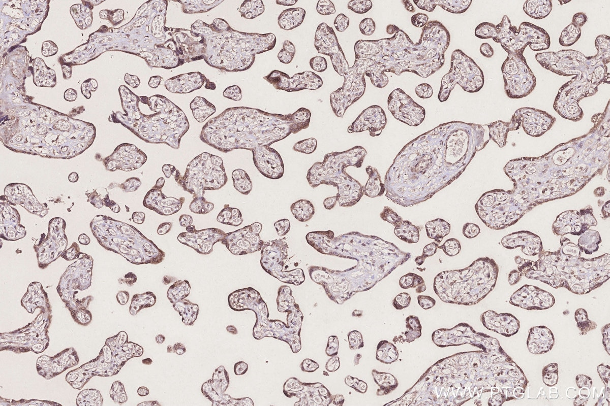 Immunohistochemistry (IHC) staining of human placenta tissue using TUSC3 Monoclonal antibody (67382-1-Ig)