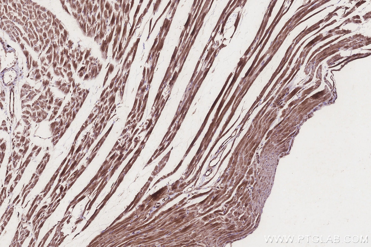 Immunohistochemistry (IHC) staining of rat heart tissue using TUSC3 Monoclonal antibody (67382-1-Ig)