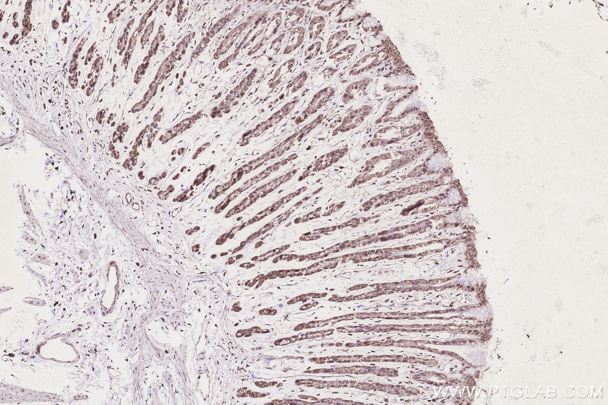 Immunohistochemistry (IHC) staining of rat stomach tissue using TUSC3 Monoclonal antibody (67382-1-Ig)