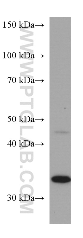 WB analysis of HeLa using 67382-1-Ig