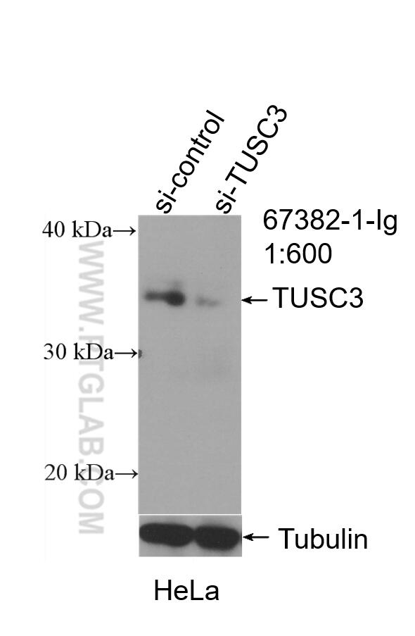 Western Blot (WB) analysis of HeLa cells using TUSC3 Monoclonal antibody (67382-1-Ig)