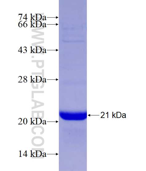 TUSC3 fusion protein Ag9197 SDS-PAGE