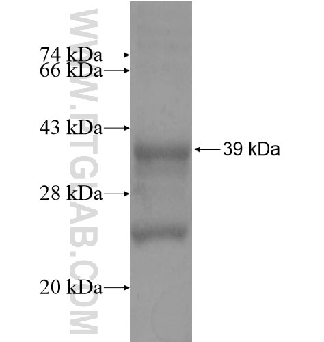 TUSC5 fusion protein Ag15572 SDS-PAGE