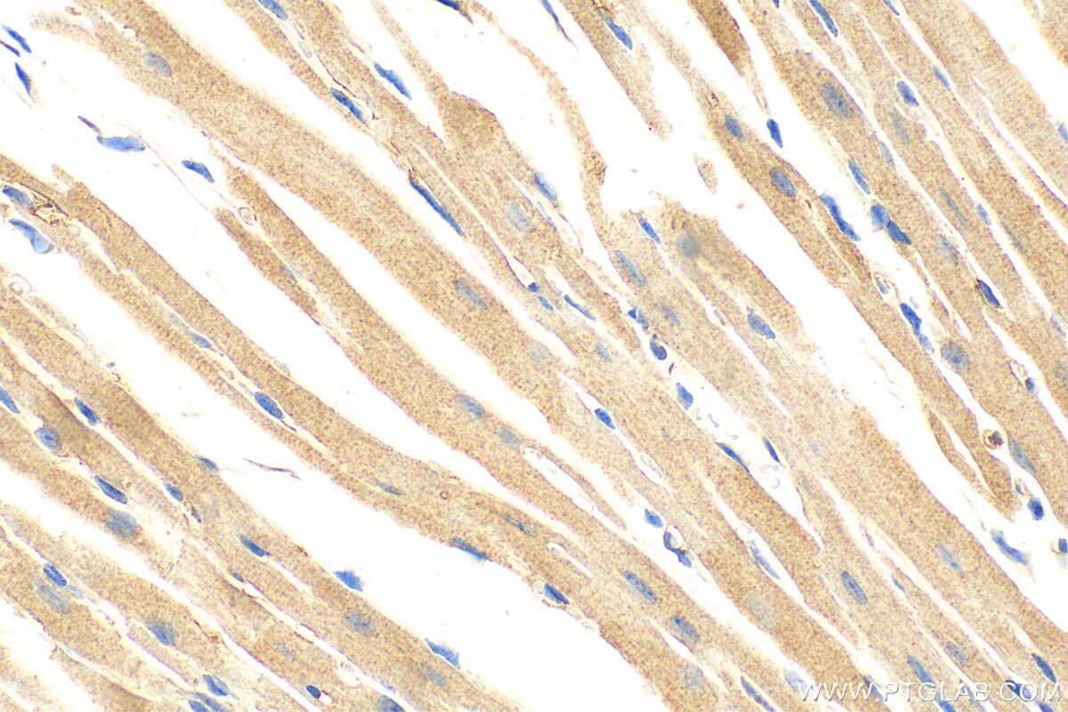 Immunohistochemistry (IHC) staining of mouse heart tissue using TWEAKR Polyclonal antibody (19836-1-AP)