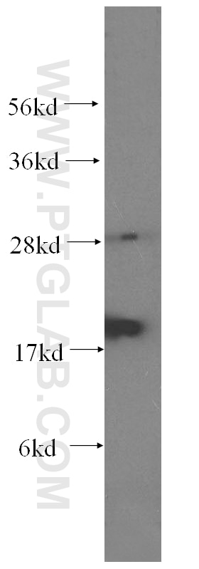 Western Blot (WB) analysis of human heart tissue using TWEAKR Monoclonal antibody (60104-1-Ig)