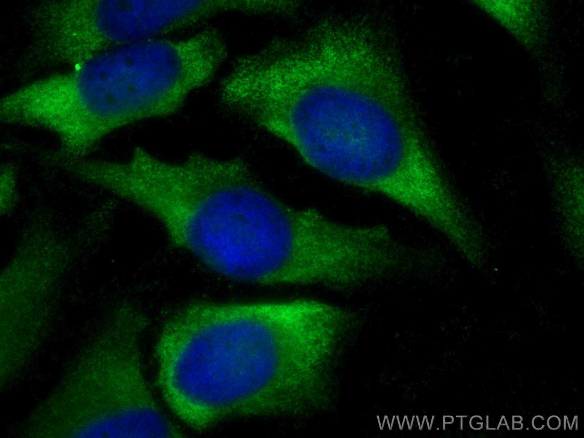 Immunofluorescence (IF) / fluorescent staining of HeLa cells using TWF1 Polyclonal antibody (11732-1-AP)