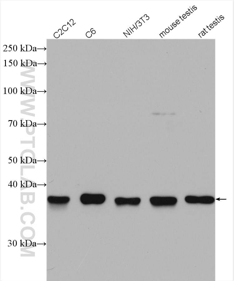 Western Blot (WB) analysis of various lysates using TWF1 Polyclonal antibody (11732-1-AP)