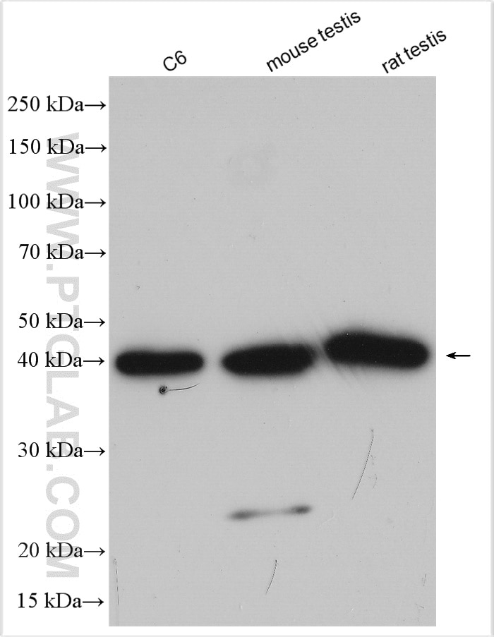 Western Blot (WB) analysis of various lysates using TWF1 Polyclonal antibody (11732-1-AP)