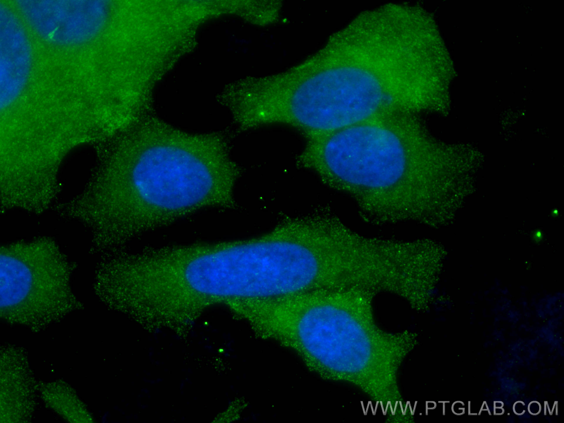 Immunofluorescence (IF) / fluorescent staining of MCF-7 cells using TWF1 Monoclonal antibody (67796-1-Ig)
