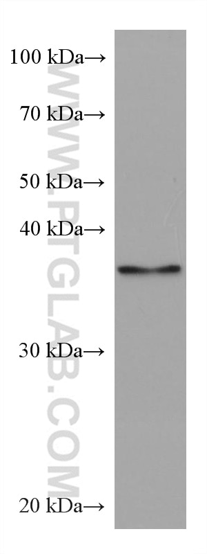 Western Blot (WB) analysis of Jurkat cells using TWF1 Monoclonal antibody (67796-1-Ig)