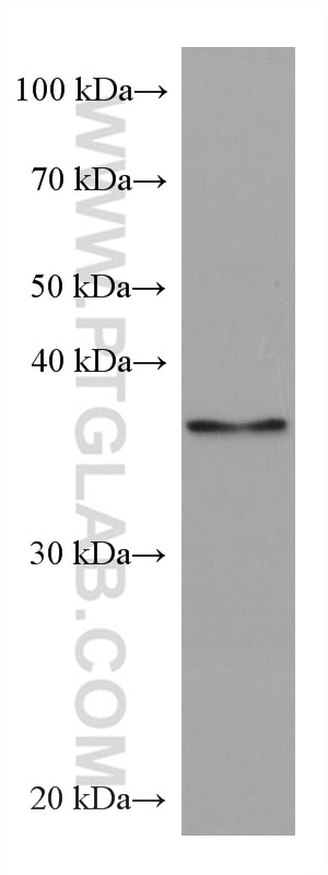 WB analysis of Jurkat using 67796-1-Ig