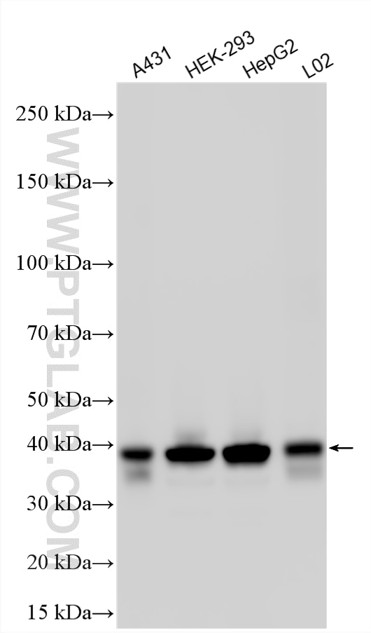 WB analysis using 14769-1-AP Western Blot (WB) analysis of various lysates using TWF2 Polyclonal antibody (14769-1-AP)