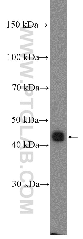 Western Blot (WB) analysis of SGC-7901 cells using TWIST1 Polyclonal antibody (18125-1-AP)