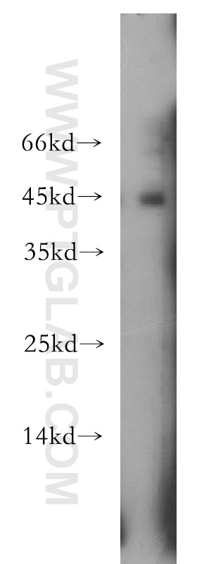 Western Blot (WB) analysis of MCF-7 cells using TWIST1 Polyclonal antibody (18125-1-AP)