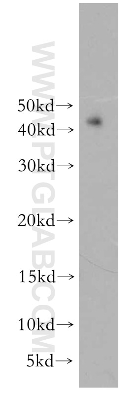 Western Blot (WB) analysis of SGC-7901 cells using TWIST1 Polyclonal antibody (18125-1-AP)