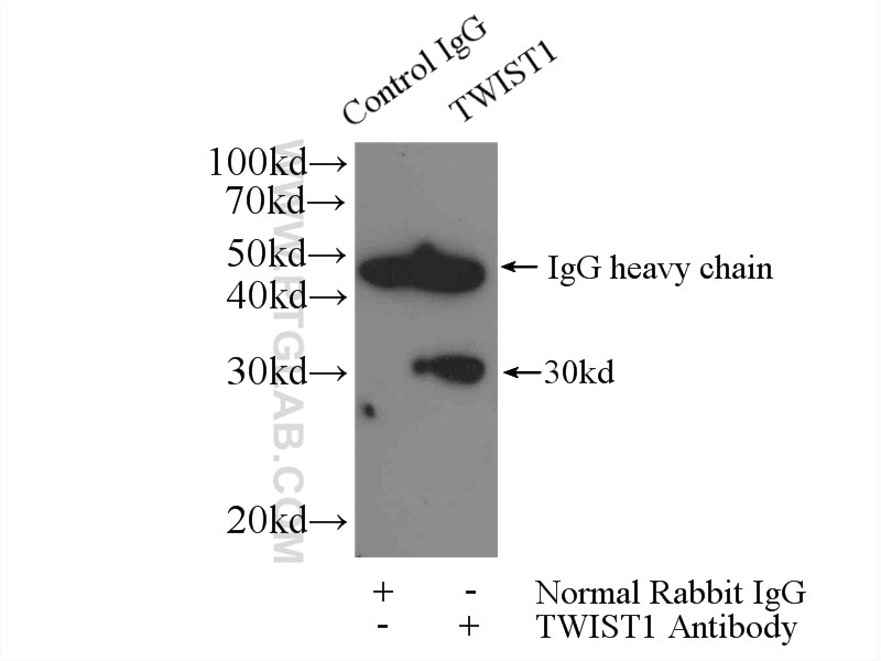 Immunoprecipitation (IP) experiment of MDA-MB-453s cells using TWIST1-specific Polyclonal antibody (25465-1-AP)