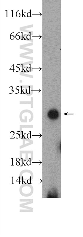 TWIST1-specific Polyclonal antibody