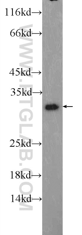 Western Blot (WB) analysis of Raji cells using TWIST1-specific Polyclonal antibody (25465-1-AP)